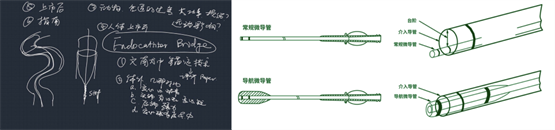 中天医疗创新神经介入器械，以新质生产力助力健康中国建设