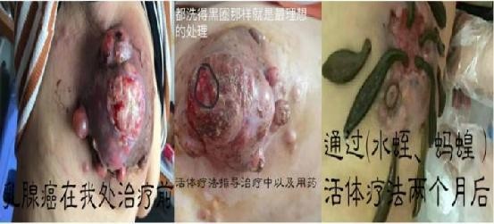	纯中医五联一体联合疗法创始人【周崇立】