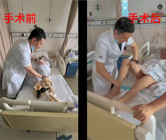 夏小雨：脊髓电刺激+外骨骼机器人，让截瘫患者重拾行走的希望