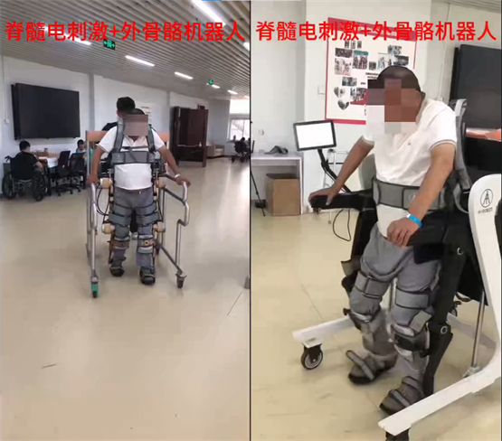 夏小雨：脊髓电刺激+外骨骼机器人，让截瘫患者重拾行走的希望