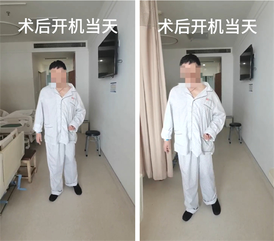 偏瘫患者治疗新希望！脊髓电刺激恢复脑梗后偏瘫患者行走能力